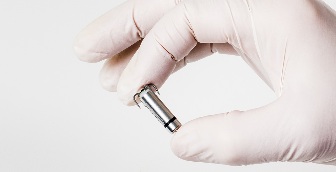 Première en Belgique francophone : implantation du plus petit pacemaker au monde à Saint-Luc. 